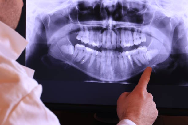 Best Holiday Emergency Dentist in Brownwood, TX