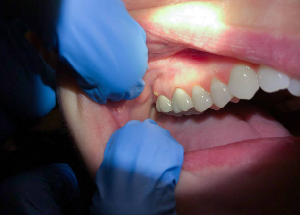 Best Weekend Emergency Dentist in Brownwood, TX
